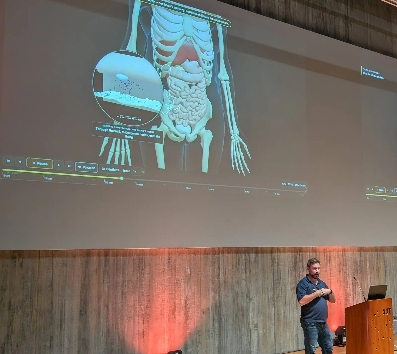 Klaus Bravenboer at the lectern beside his narrated 3D digital twin, a reference body that walks through the scans and reports in date order